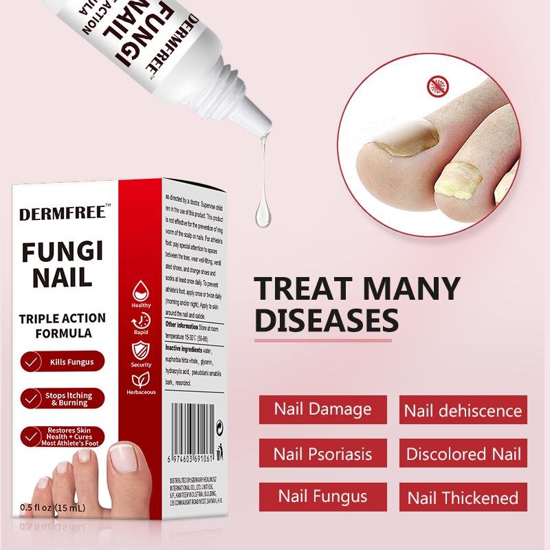 Toenail Fungus Treatment